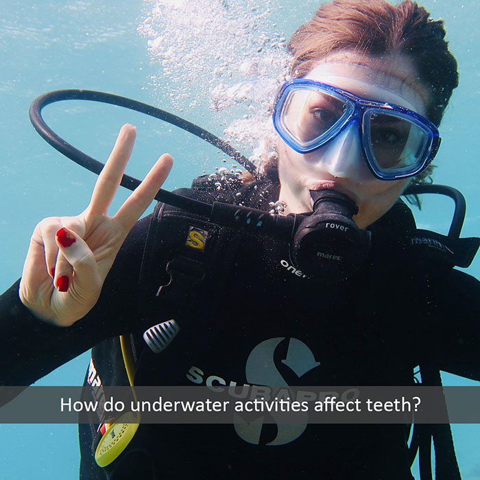 underwater teeth 2022 700 Emerald Isle Smiles: Aubrey Myers, DDS Emerald Isle NC
