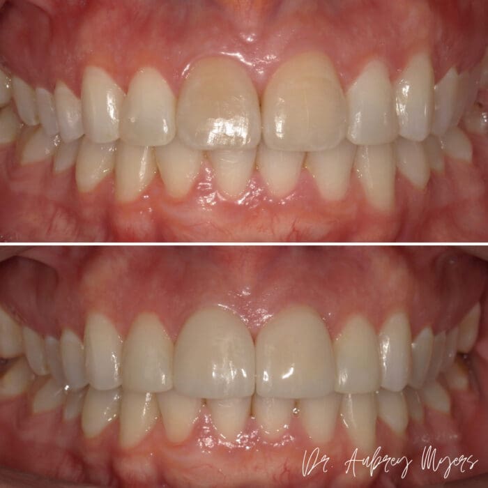 Main Gallery Image 5 | Smile Gallery